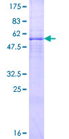A4GALT Protein - 12.5% SDS-PAGE of human A4GALT stained with Coomassie Blue