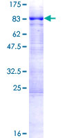 AAAS / Adracalin Protein - 12.5% SDS-PAGE of human AAAS stained with Coomassie Blue