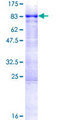 AAAS / Adracalin Protein - 12.5% SDS-PAGE of human AAAS stained with Coomassie Blue