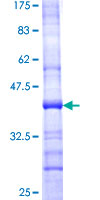 AAAS / Adracalin Protein - 12.5% SDS-PAGE Stained with Coomassie Blue.