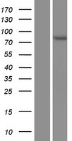 AACS Protein - Western validation with an anti-DDK antibody * L: Control HEK293 lysate R: Over-expression lysate
