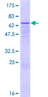 AACS Protein - 12.5% SDS-PAGE of human AACS stained with Coomassie Blue