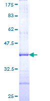 AACS Protein - 12.5% SDS-PAGE Stained with Coomassie Blue.