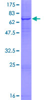 AADAC Protein - 12.5% SDS-PAGE of human AADAC stained with Coomassie Blue