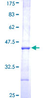 AADAC Protein - 12.5% SDS-PAGE Stained with Coomassie Blue.