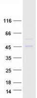 AADACL2 Protein - Purified recombinant protein AADACL2 was analyzed by SDS-PAGE gel and Coomassie Blue Staining