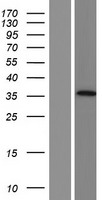 AADACL3 Protein - Western validation with an anti-DDK antibody * L: Control HEK293 lysate R: Over-expression lysate