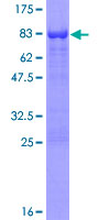 AAK1 Protein - 12.5% SDS-PAGE of human AAK1 stained with Coomassie Blue