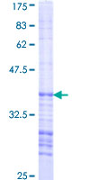 AAK1 Protein - 12.5% SDS-PAGE Stained with Coomassie Blue.