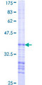 AAK1 Protein - 12.5% SDS-PAGE Stained with Coomassie Blue.