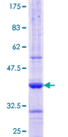 AAMP Protein - 12.5% SDS-PAGE Stained with Coomassie Blue.