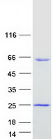 AAMP Protein - Purified recombinant protein AAMP was analyzed by SDS-PAGE gel and Coomassie Blue Staining