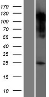 AANAT Protein - Western validation with an anti-DDK antibody * L: Control HEK293 lysate R: Over-expression lysate