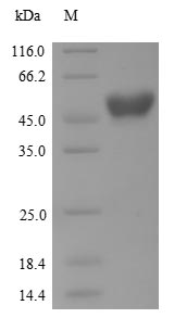 AANAT Protein - (Tris-Glycine gel) Discontinuous SDS-PAGE (reduced) with 5% enrichment gel and 15% separation gel.