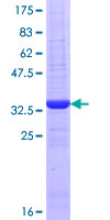AANAT Protein - 12.5% SDS-PAGE Stained with Coomassie Blue.