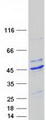 AAR2 Protein - Purified recombinant protein AAR2 was analyzed by SDS-PAGE gel and Coomassie Blue Staining