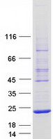 AARD Protein - Purified recombinant protein AARD was analyzed by SDS-PAGE gel and Coomassie Blue Staining