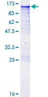 AARS Protein - 12.5% SDS-PAGE of human AARS stained with Coomassie Blue