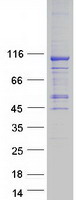 AARS2 Protein - Purified recombinant protein AARS2 was analyzed by SDS-PAGE gel and Coomassie Blue Staining