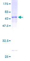 AASDHPPT / LYS5 Protein - 12.5% SDS-PAGE of human AASDHPPT stained with Coomassie Blue