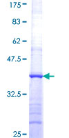 AASDHPPT / LYS5 Protein - 12.5% SDS-PAGE Stained with Coomassie Blue.