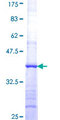 AASDHPPT / LYS5 Protein - 12.5% SDS-PAGE Stained with Coomassie Blue.