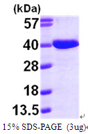 AASDHPPT / LYS5 Protein