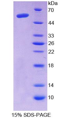 AASS / LKR / SDH Protein - Recombinant  Aminoadipate Semialdehyde Synthase By SDS-PAGE