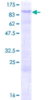 AATF Protein - 12.5% SDS-PAGE of human AATF stained with Coomassie Blue