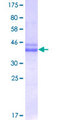 AATF Protein - 12.5% SDS-PAGE Stained with Coomassie Blue.