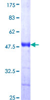 AATK / AATYK Protein - 12.5% SDS-PAGE Stained with Coomassie Blue.