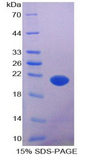 AATK / AATYK Protein - Recombinant Apoptosis Associated Tyrosine Kinase By SDS-PAGE