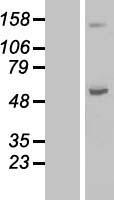 ABAT Protein - Western validation with an anti-DDK antibody * L: Control HEK293 lysate R: Over-expression lysate