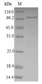 ABAT Protein - (Tris-Glycine gel) Discontinuous SDS-PAGE (reduced) with 5% enrichment gel and 15% separation gel.