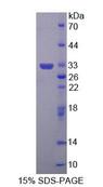 ABAT Protein - Recombinant 4-Aminobutyrate Aminotransferase (ABAT) by SDS-PAGE