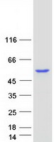 ABAT Protein - Purified recombinant protein ABAT was analyzed by SDS-PAGE gel and Coomassie Blue Staining