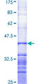 ABCA1 Protein - 12.5% SDS-PAGE Stained with Coomassie Blue.