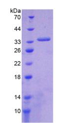 ABCA1 Protein - Recombinant ATP Binding Cassette Transporter A1 By SDS-PAGE