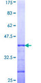 ABCA2 Protein - 12.5% SDS-PAGE Stained with Coomassie Blue.