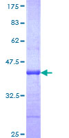ABCA4 Protein - 12.5% SDS-PAGE Stained with Coomassie Blue.