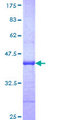 ABCA4 Protein - 12.5% SDS-PAGE Stained with Coomassie Blue.