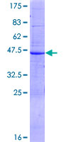 ABCA6 Protein - 12.5% SDS-PAGE of human ABCA6 stained with Coomassie Blue