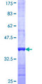ABCA6 Protein - 12.5% SDS-PAGE Stained with Coomassie Blue.