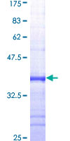 ABCB1 / MDR1 / P Glycoprotein Protein - 12.5% SDS-PAGE Stained with Coomassie Blue.