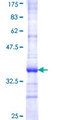 ABCB10 Protein - 12.5% SDS-PAGE Stained with Coomassie Blue.