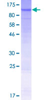 ABCB2 / TAP1 Protein - 12.5% SDS-PAGE of human TAP1 stained with Coomassie Blue