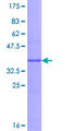 ABCB2 / TAP1 Protein - 12.5% SDS-PAGE Stained with Coomassie Blue