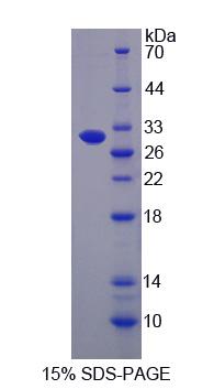 ABCB5 Protein - Recombinant  ATP Binding Cassette Transporter B5 By SDS-PAGE