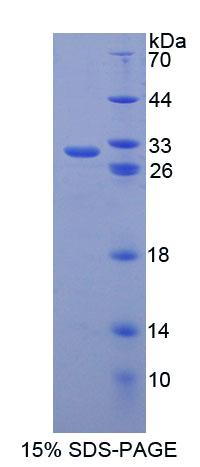 ABCB6 Protein - Recombinant ATP Binding Cassette Transporter B6 (ABCB6) by SDS-PAGE