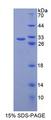 ABCB6 Protein - Recombinant ATP Binding Cassette Transporter B6 (ABCB6) by SDS-PAGE